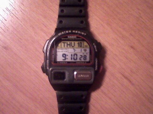 Vérnyomásmérő karóra